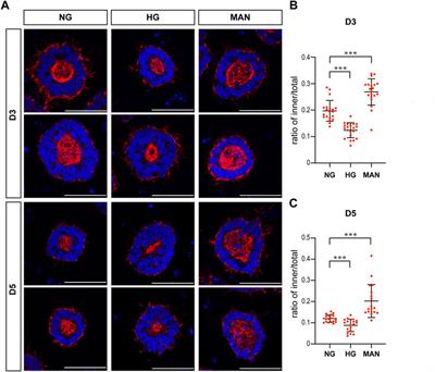 High glucose causes developmental abnormalities in neuroepithelial cysts with actin and HK1 distribution changes